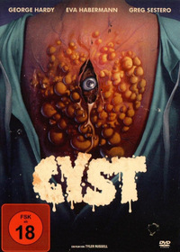 Cyst (DVD)