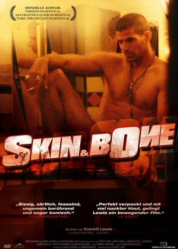 Skin & Bone - Poster 1
