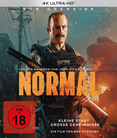 Normal