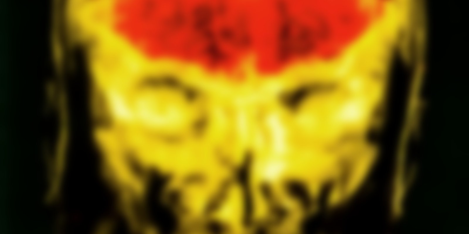 Mindstorm