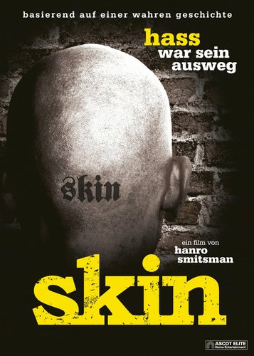 Skin - Hass war sein Ausweg - Poster 1