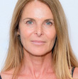 Catherine Oxenberg
