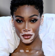 Winnie Harlow
