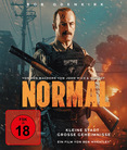 Normal