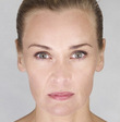 Line Verndal