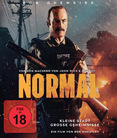Normal